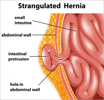 Herania Repair